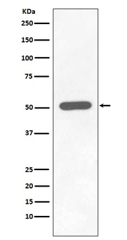 Phospho-Chk1 CHEK1 Rabbit Monoclonal Antibody