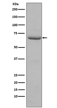 Phospho-PKR EIF2AK2/PKR Rabbit Monoclonal Antibody