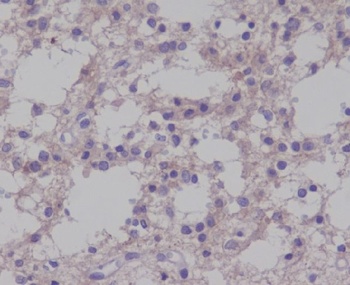 Phospho-TrkB NTRK2 Rabbit Monoclonal Antibody