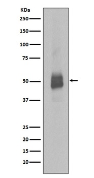 Phospho-Lyn Rabbit Monoclonal Antibody