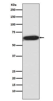 Phospho-S6K1 RPS6KB1/S6K1 Rabbit Monoclonal Antibody