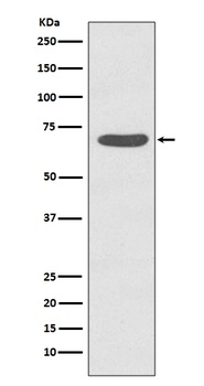 Phospho-PKC zeta PRKCZ/PKC Rabbit Monoclonal Antibody