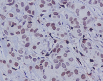 Phospho-c-Jun Rabbit Monoclonal Antibody