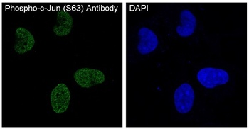 Phospho-c-Jun Rabbit Monoclonal Antibody