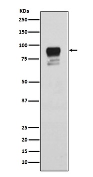 Phospho-Glycogen synthase 1 GYS1 Rabbit Monoclonal Antibody