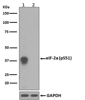 Phospho-EIF2S1/EIF2S1 Rabbit Monoclonal Antibody