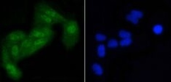 Phospho-EIF2S1/EIF2S1 Rabbit Monoclonal Antibody