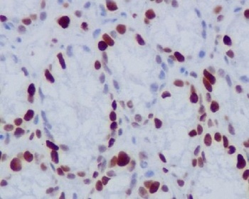 Phospho-Histone H1.4 HIST1H1E/H1 Rabbit Monoclonal Antibody