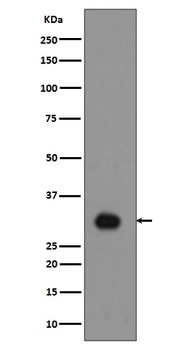 Phospho-Histone H1.4 HIST1H1E/H1 Rabbit Monoclonal Antibody