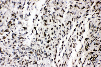 AREB6/ZEB1 Rabbit Polyclonal Antibody