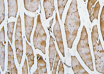 Cofilin 2/CFL2 Antibody (monoclonal, 8C13)