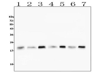 Cofilin 2/CFL2 Antibody (monoclonal, 8C13)