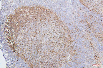 CDK1 Mouse Monoclonal Antibody