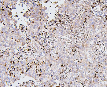BAK/BAK1 Antibody (monoclonal, 4C2)