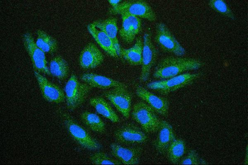 Hsp27/HSPB1 Antibody (monoclonal, 3H3)
