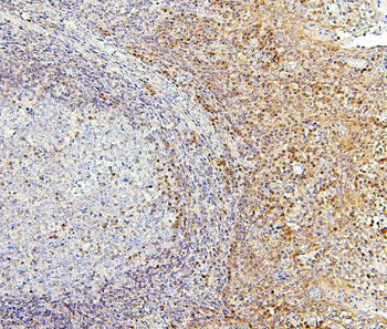 PPCS Mouse Monoclonal Antibody