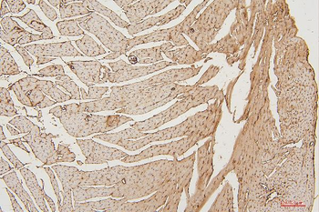 PPCS Mouse Monoclonal Antibody