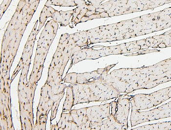 PPCS Mouse Monoclonal Antibody