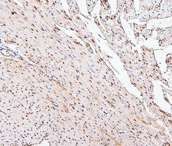 PPCS Mouse Monoclonal Antibody