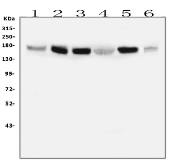 IRS1 Mouse Monoclonal Antibody