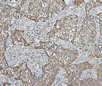 Hsp60/HSPD1 Antibody (monoclonal, 6G2)