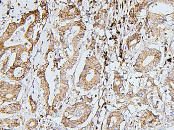 SDHB Mouse Monoclonal Antibody