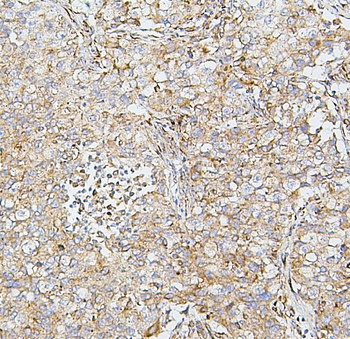 SDHB Mouse Monoclonal Antibody