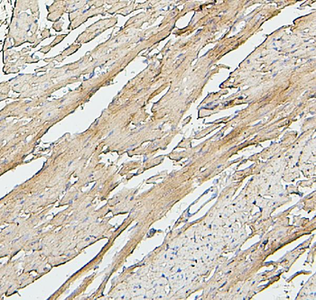 SDHB Mouse Monoclonal Antibody
