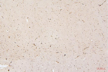 HMGB1 Antibody (monoclonal, 5H3)