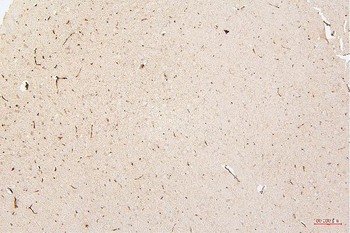 HMGB1 Antibody (monoclonal, 5H3)