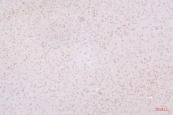 HMGB1 Antibody (monoclonal, 5H3)