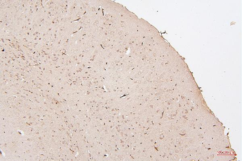 HMGB1 Antibody (monoclonal, 5H3)