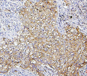 SQSTM1/p62 Antibody (monoclonal, 3H11)