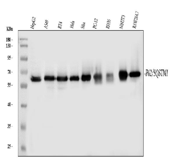 SQSTM1/p62 Antibody (monoclonal, 3H11)