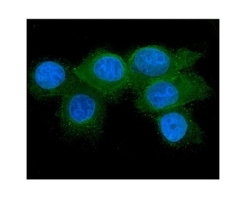 RAB27A Mouse Monoclonal Antibody