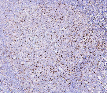 RAB27A Mouse Monoclonal Antibody