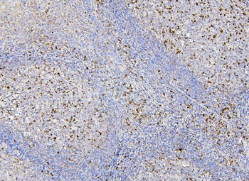 RAB27A Mouse Monoclonal Antibody