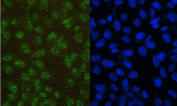 PAX5 Mouse Monoclonal Antibody