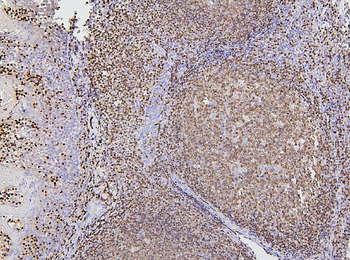 PAX5 Mouse Monoclonal Antibody