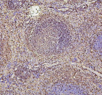 PAX5 Mouse Monoclonal Antibody