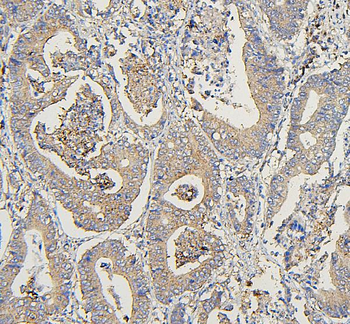 COPE Mouse Monoclonal Antibody