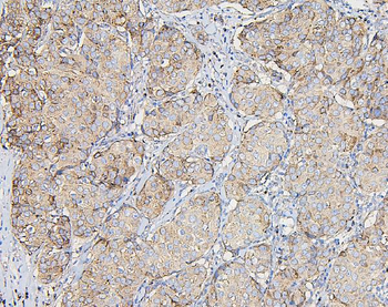 COPE Mouse Monoclonal Antibody