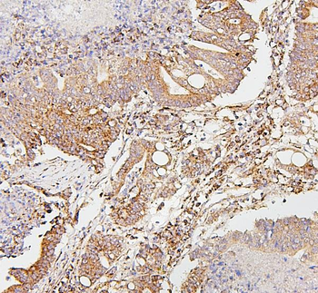 SDHB Mouse Monoclonal Antibody