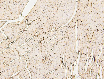 SDHB Mouse Monoclonal Antibody
