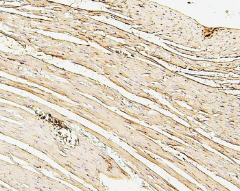 SDHB Mouse Monoclonal Antibody