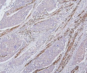 Desmin Mouse Monoclonal Antibody