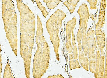 Desmin Mouse Monoclonal Antibody