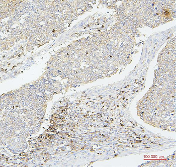 CD43/SPN Mouse Monoclonal Antibody