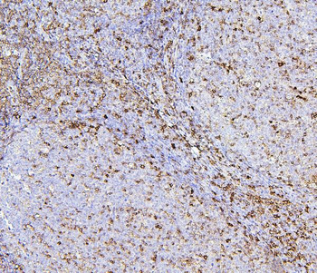CD43/SPN Mouse Monoclonal Antibody