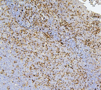 CD43/SPN Mouse Monoclonal Antibody